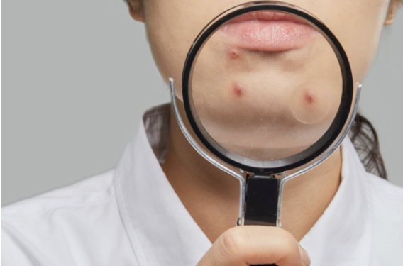 임신 전 ‘이 약’ 복용 중이라면 주의하세요